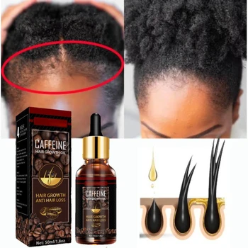 Средство за лечение на оплешивяване за жени, средство за растежа на масла за коса, спрей с кофеин за лечение на суха увивни повредени тънка коса